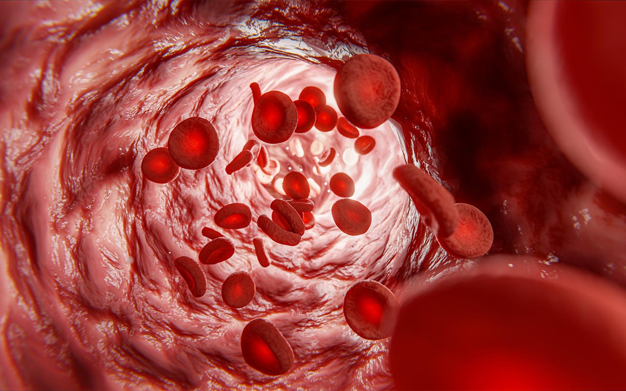 Módulo 1. Subtipos, desenlaces clínicos y anormalidades de laboratorio asociadas a Enfermedad de Gaucher