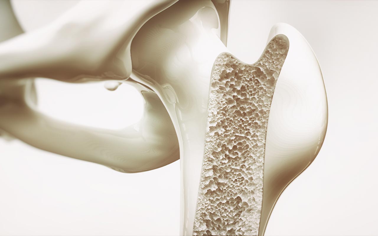 Módulo 4. Algoritmo de tratamiento y metas terapéuticas: alteraciones hematológicas, salud ósea, y prevención de otras complicaciones